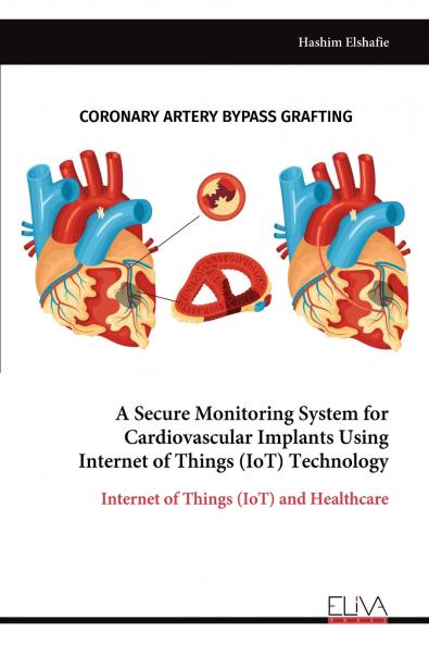 A Secure Monitoring System for Cardiovascular Implants Using Internet of Things (IoT) Technology