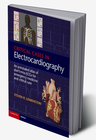 Critical Cases in Electrocardiography