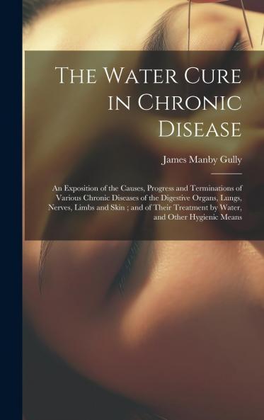 Water Cure in Chronic Disease: An Exposition of the Causes Progress and Terminations of Various Chronic Diseases of the Digestive Organs Lungs Nerves and of Skin; And of Their Treatment by Water and Other Hygienic Means (Classic Reprint)