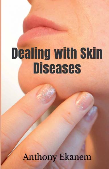 Dealing with Skin Diseases