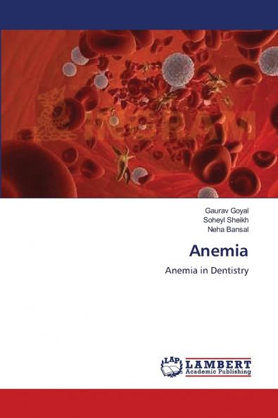 Anemia