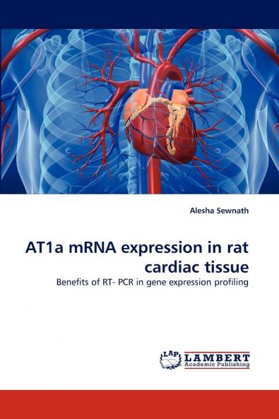 AT1a mRNA expression in rat cardiac tissue