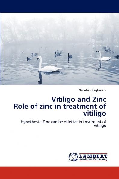 Vitiligo and Zinc  Role of zinc in treatment of vitiligo