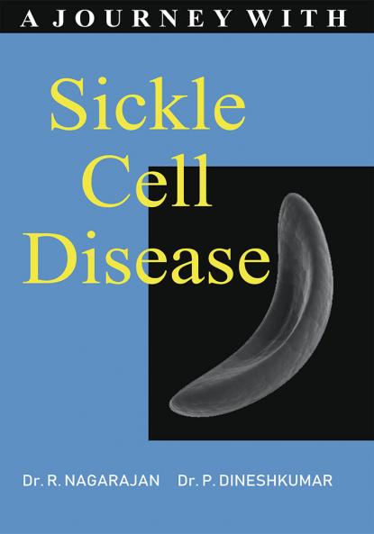 A JOURNEY WITH SICKLE CELL DISEASE