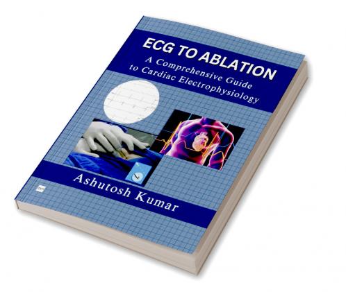 ECG TO ABLATION: A COMPREHENSIVE GUIDE TO CARDIAC ELECTROPHYSIOLOGY