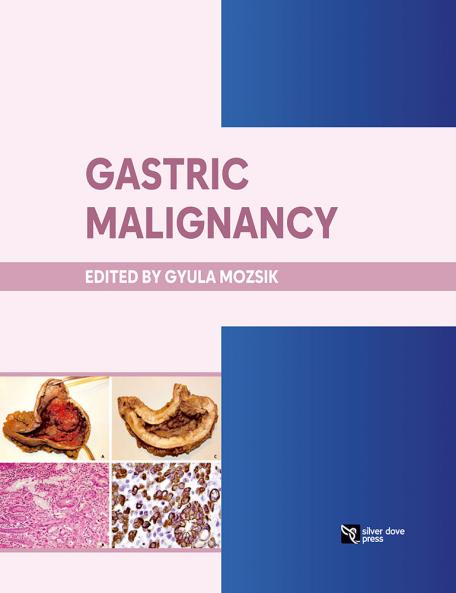Gastric Malignancy