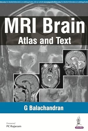 MRI BRAIN:ATLAS AND TEXT