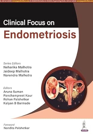 CLINICAL FOCUS ON ENDOMETRIOSIS