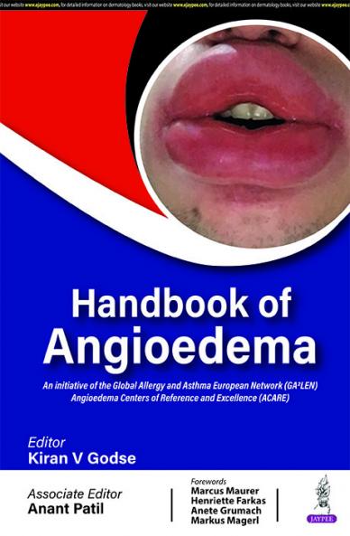 Handbook of Angioedema