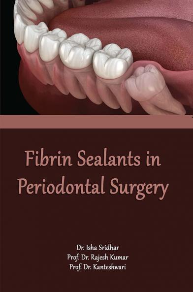 Fibrin Sealants In Periodontal Surgery