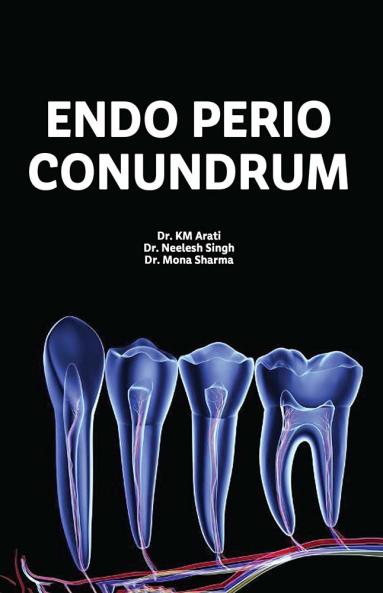 ENDO - PERIO CONUNDRUM