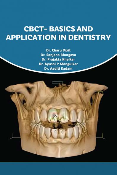 CBCT-BASICS AND APPLICATION IN DENTISTRY