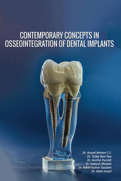 Contemporary Concepts In Osseointegration of Dental Implants