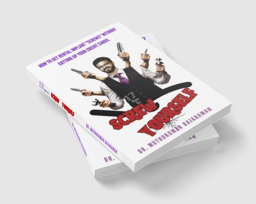 How to Get Dental Implant Screws Without Cutting Up Your Credit Cards: 17 Tips to Screw Yourself