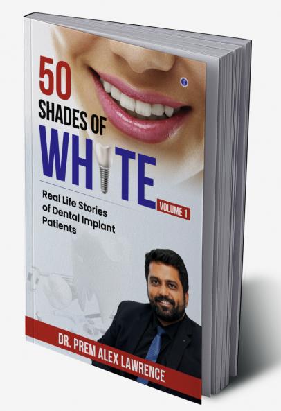 50 Shades of White: Real Life Stories of Dental Implant Patients