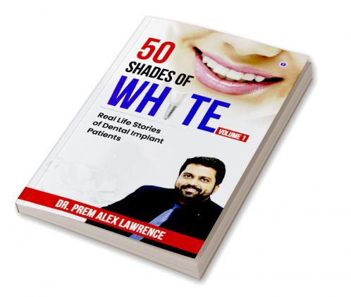 50 Shades of White: Real Life Stories of Dental Implant Patients