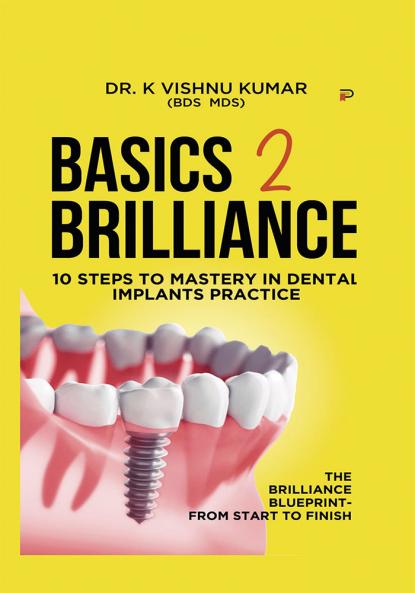 Basics to Brilliance in Dental Implants: 10 Clinical Steps