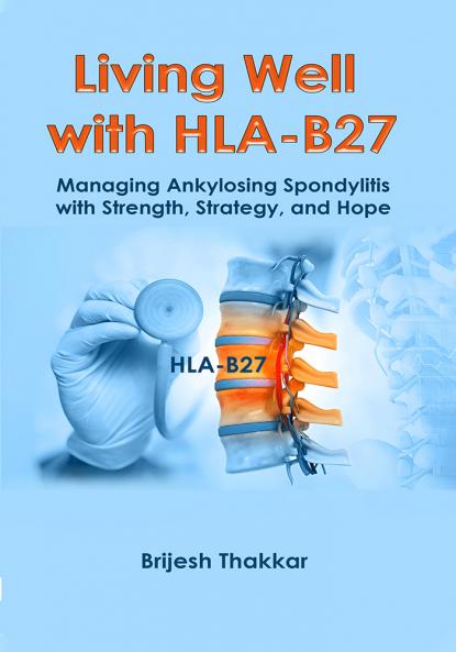 Living Well With HLA-B27 : Managing Ankylosing Spondylitis With Strength Strategy and Hope