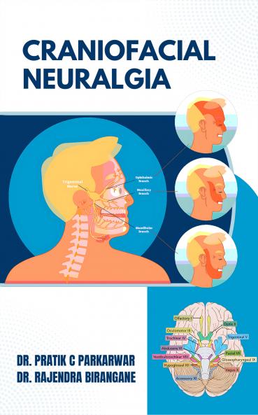 Craniofacial Neuralgia