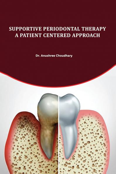 SUPPORTIVE PERIODONTAL THERAPY: A PATIENT CENTERED APPROACH