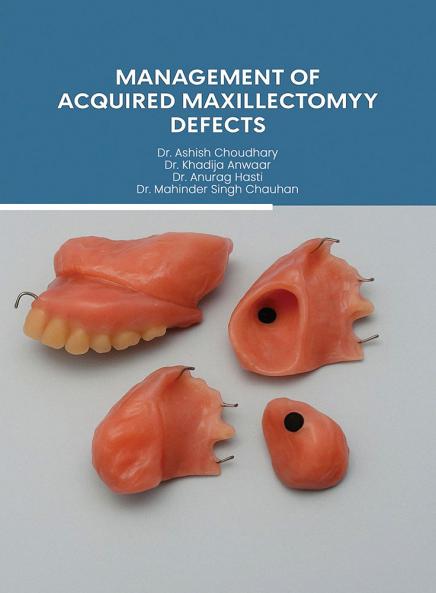 MANAGEMENT OF ACQUIRED  MAXILLECTOMY DEFECTS