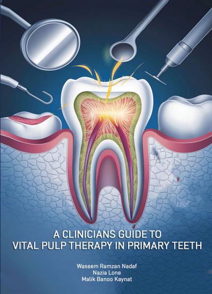 A Clinicians Guide to Vital Pulp Therapy in Primary Teeth