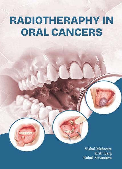 Radiotheraphy In Oral Cancers
