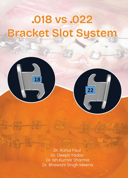 0.018 VS 0.022  Bracket Slot System