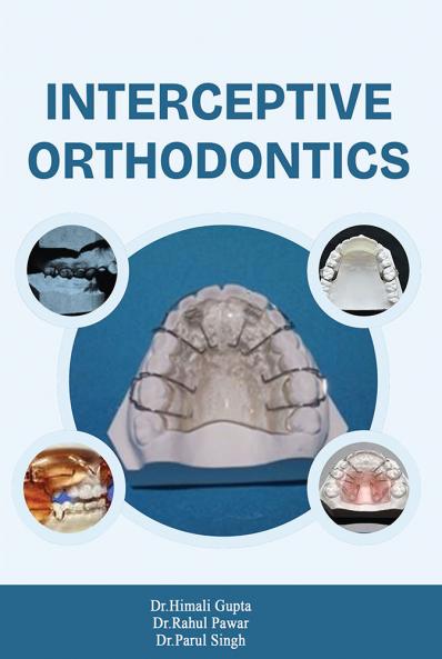 Interceptive Orthodontics