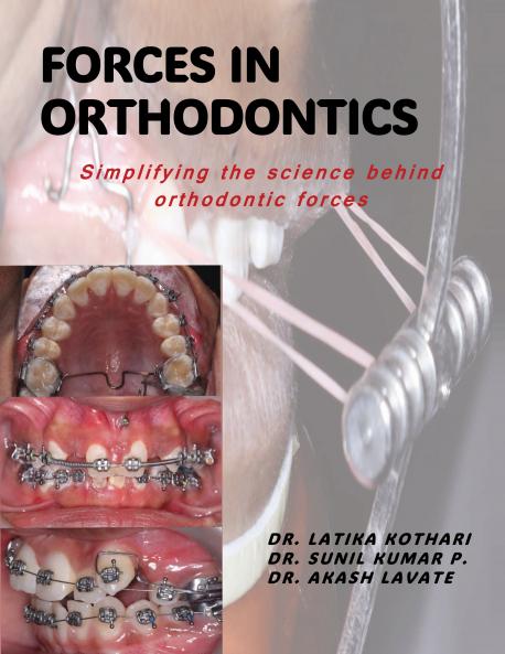 Forces in Orthodontics