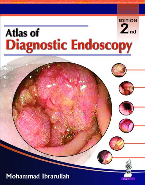 Atlas of Diagnostic Endoscopy