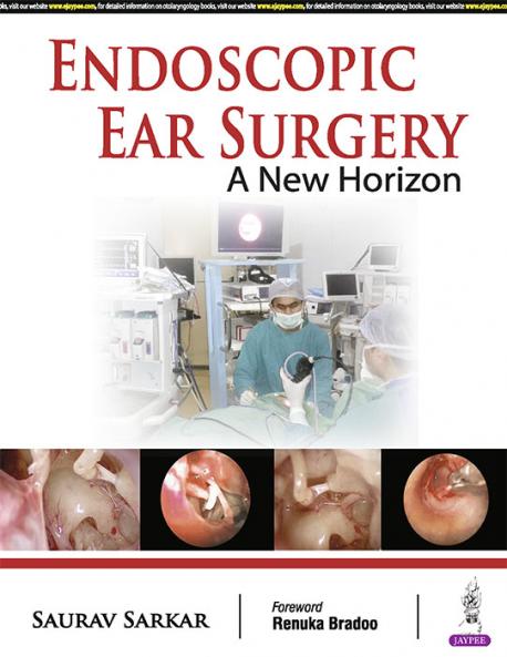 ENDOSCOPIC EAR SURGERY A NEW HORIZON