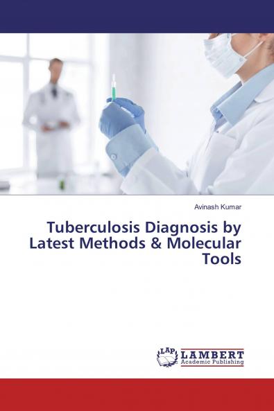Tuberculosis Diagnosis by Latest Methods & Molecular Tools