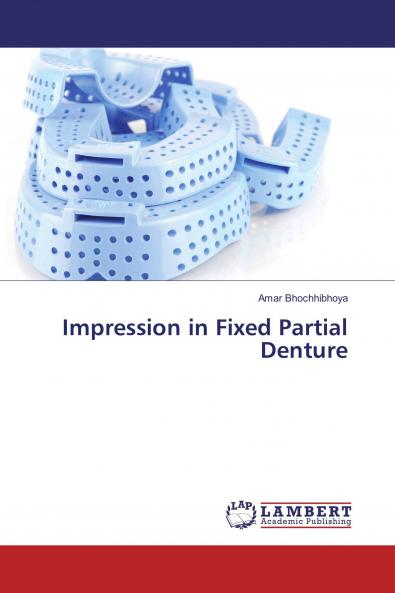 Impression in Fixed Partial Denture