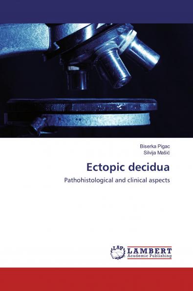 Ectopic decidua
