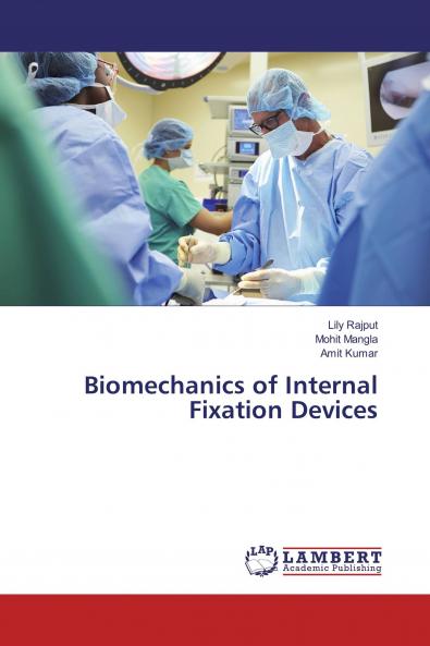 Biomechanics of Internal Fixation Devices