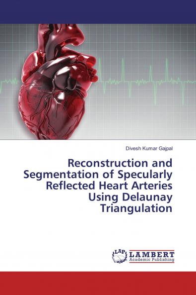 Reconstruction and Segmentation of Specularly Reflected Heart Arteries Using Delaunay Triangulation