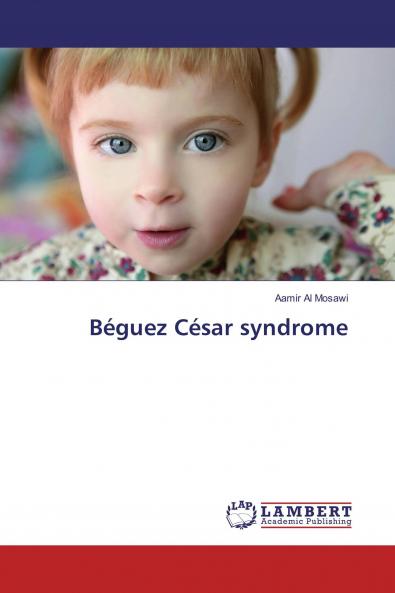 B��guez C��sar syndrome