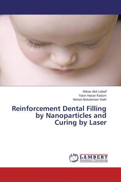 Reinforcement Dental Filling by Nanoparticles and Curing by Laser