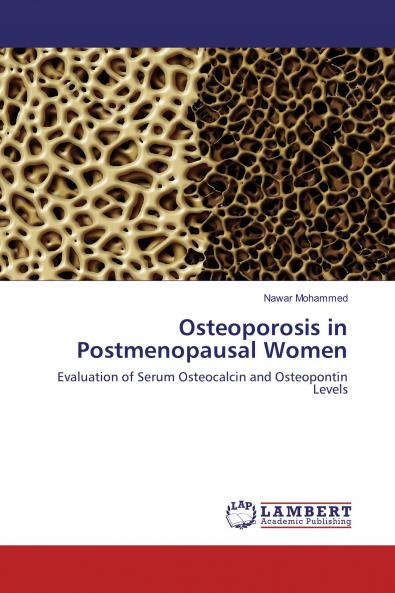 Osteoporosis in Postmenopausal Women