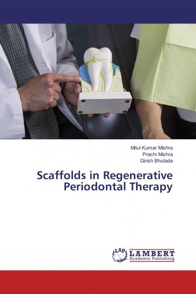 Scaffolds in Regenerative Periodontal Therapy