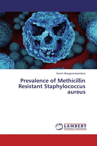 Prevalence of Methicillin Resistant Staphylococcus aureus