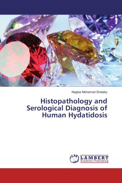 Histopathology and Serological Diagnosis of Human Hydatidosis