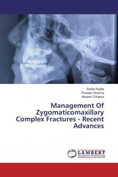 Management Of Zygomaticomaxillary Complex Fractures - Recent Advances
