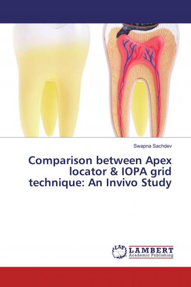 Comparison between Apex locator & IOPA grid technique: An Invivo Study