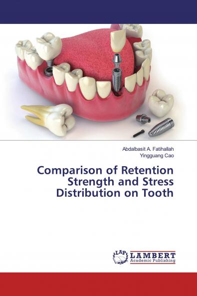 Comparison of Retention Strength and Stress Distribution on Tooth
