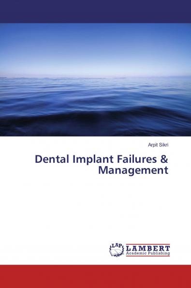 Dental Implant Failures & Management