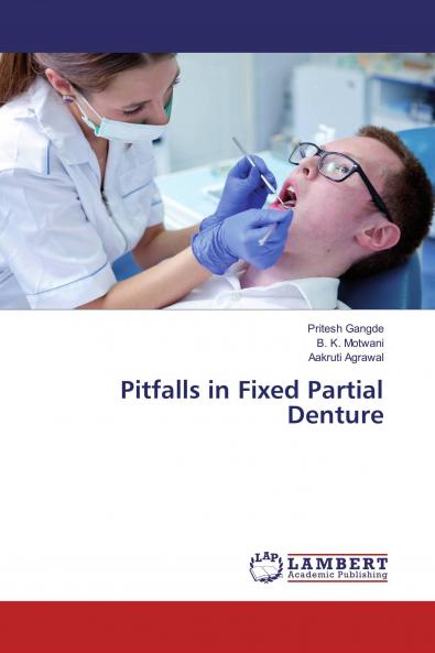 Pitfalls in Fixed Partial Denture