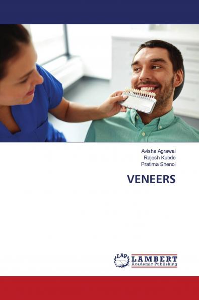 VENEERS