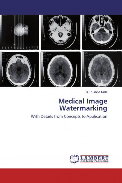 Medical Image Watermarking